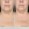 ELASTIderm® Neck and Decollete Concentrate - Image 3