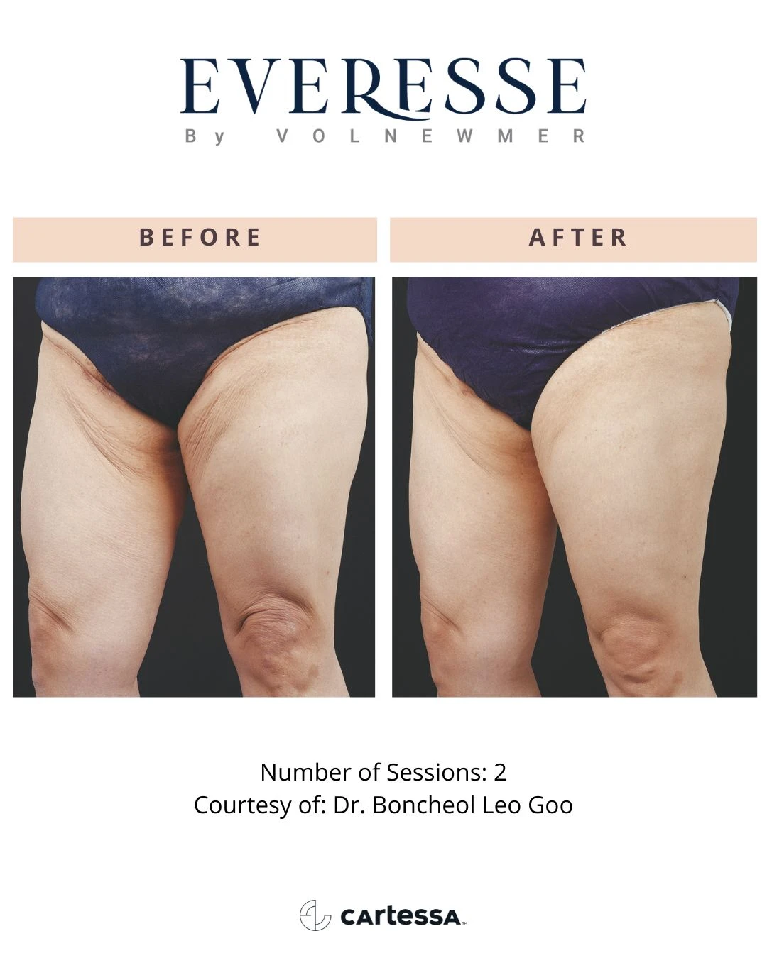 DrBoncheolLeoGoo-syracuse medical aesthetics in Syracuse, NY (2)