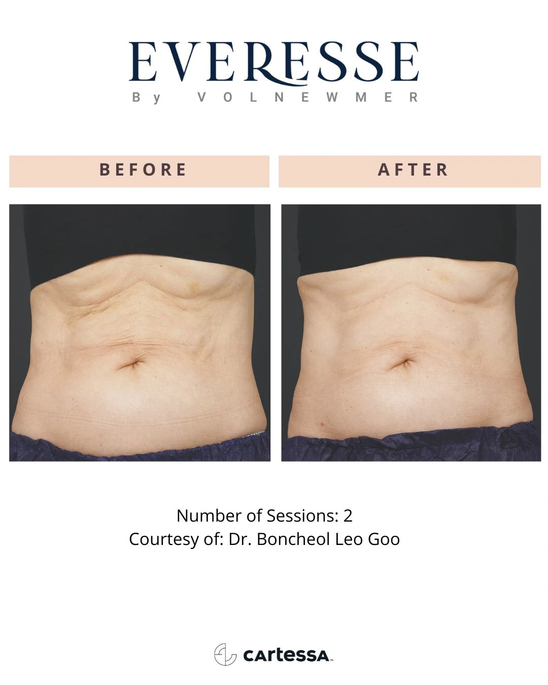 DrBoncheolLeoGoo-syracuse medical aesthetics in Syracuse, NY