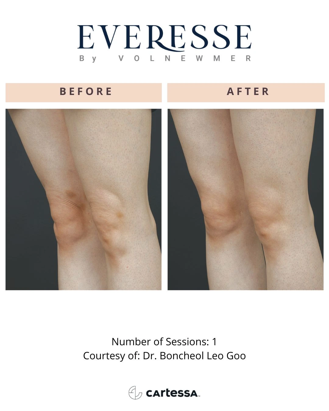 DrBoncheolLeoGoo6-syracuse medical aesthetics in Syracuse, NY