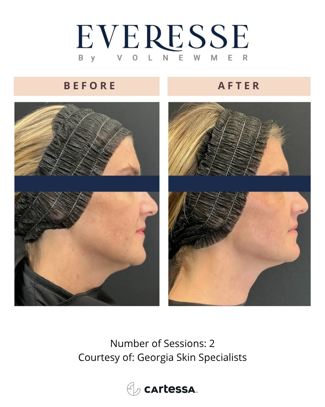 GeorgiaSkinSpecialists-syracuse medical aesthetics in Syracuse, NY