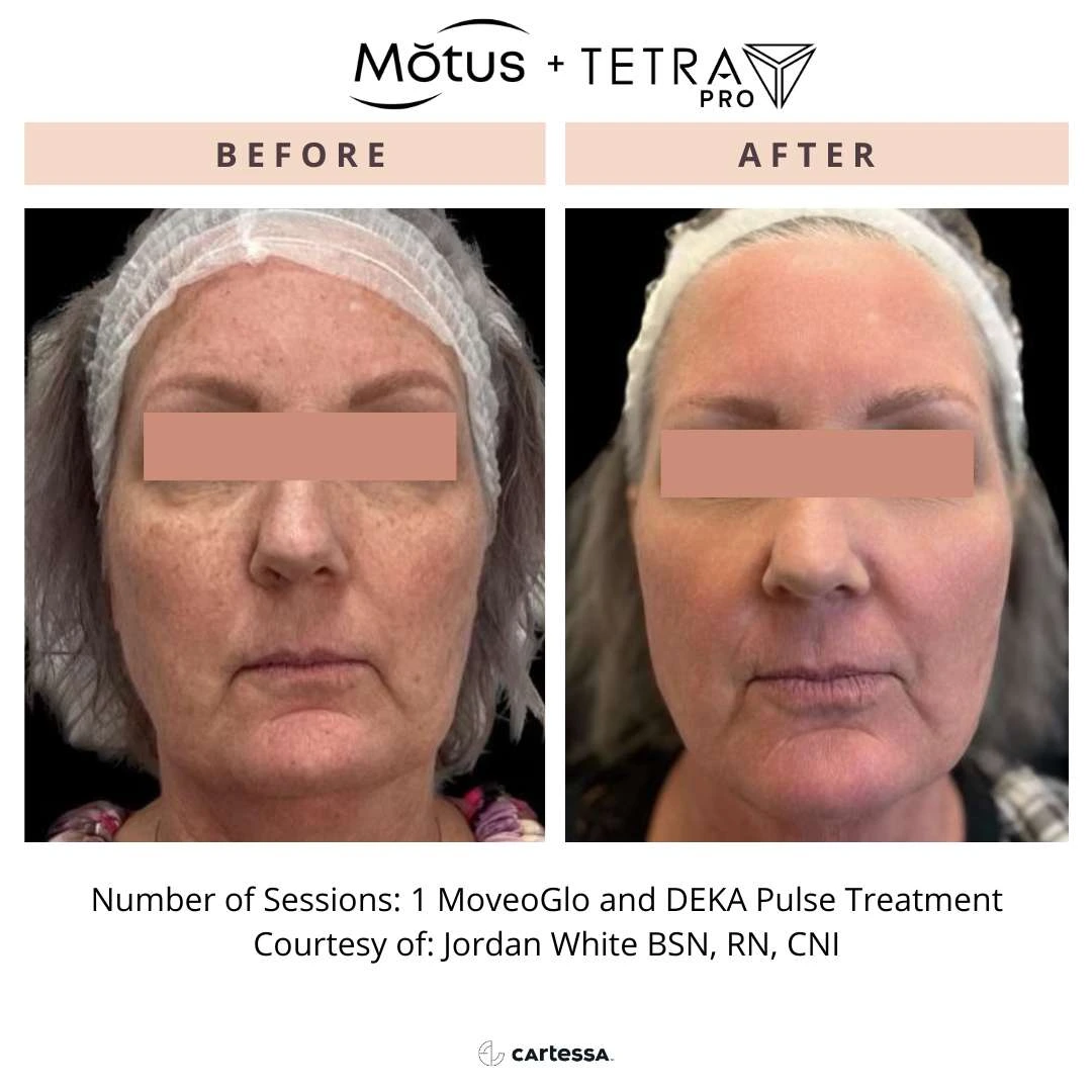 MotusAZ-syracuse-medical-aesthetics-in-Syracuse-NY