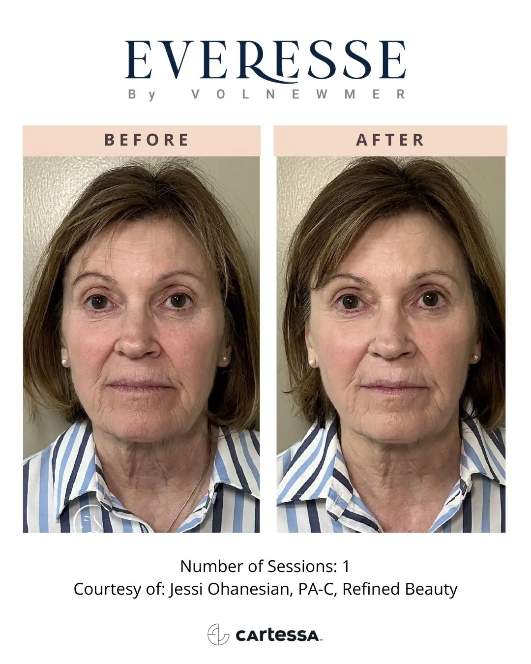 RefinedBeauty-syracuse medical aesthetics in Syracuse, NY