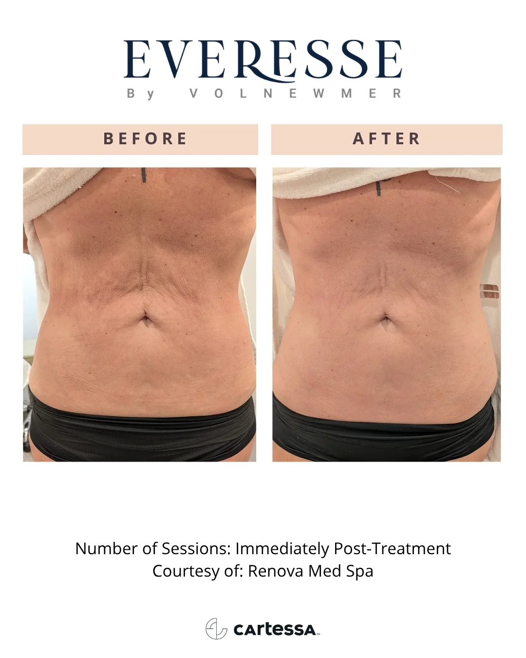 RenovaMedSpa-syracuse medical aesthetics in Syracuse, NY