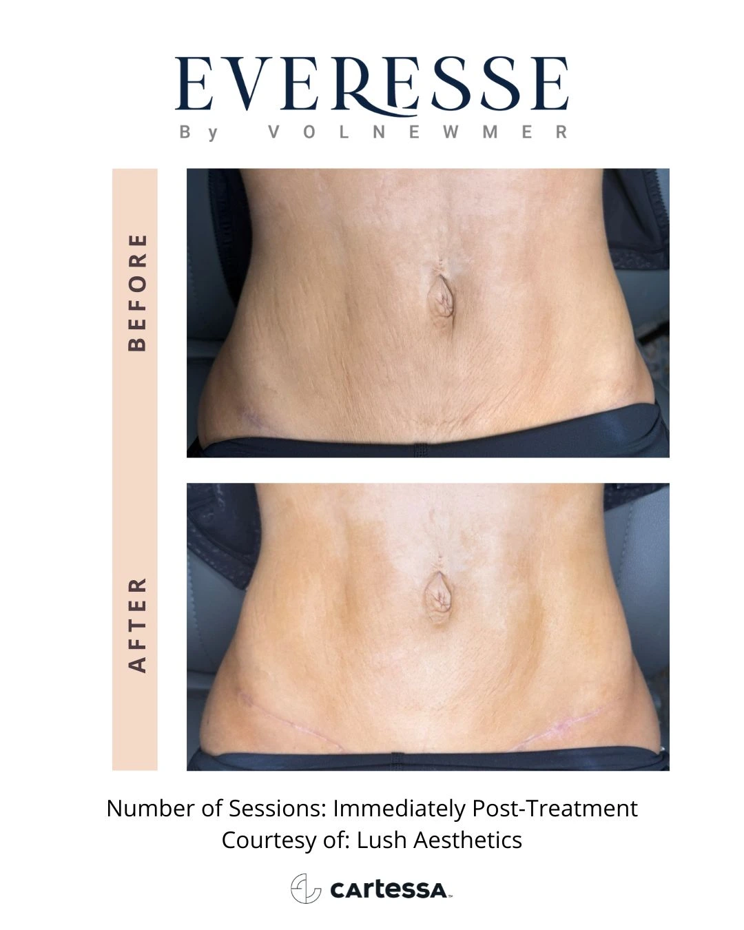 lushaesthetics-syracuse medical aesthetics in Syracuse, NY