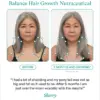 Women’s Balance Hair Growth Nutraceutical - Image 2